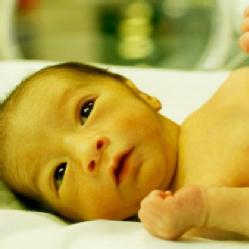 El niño presenta el síntoma más llamativo de esta enfermedad, la piel amarilla. Los que contraen ictericia son, normalmente, recién nacidos.